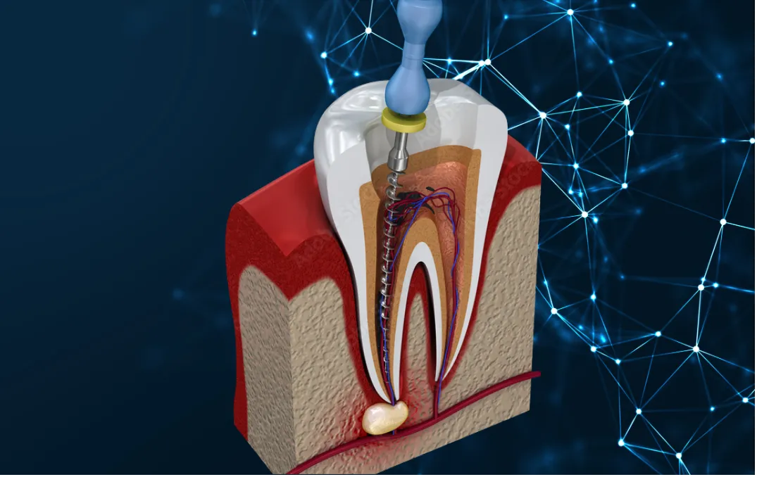 東京都渋谷区代官山の歯医者・歯科「代官山WADA歯科・矯正歯科」|歯をのこす精密根幹治療の画像