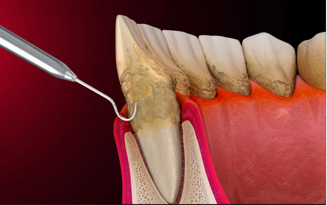 東京都渋谷区代官山の歯医者・歯科「代官山WADA歯科・矯正歯科」|歯を残す精密歯周病治療の画像